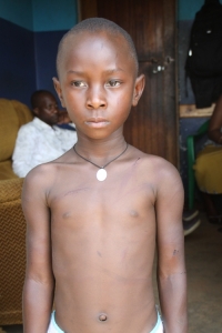 Little Susan Christine with wounds on her chest.