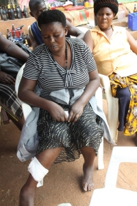 Business woman Nabukeera with injured leg. She sustained the injury after she tried to save her Shs 14.8m from the house.