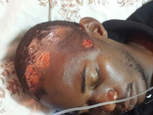 Kiwanuka in too much pain