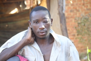 Kakooza Tadeo with swollen paining eye.