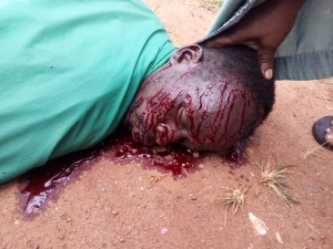 Boda Boda rider Eric Katende oozing blood after he was knocked dead on Monday near Muzinga Park.