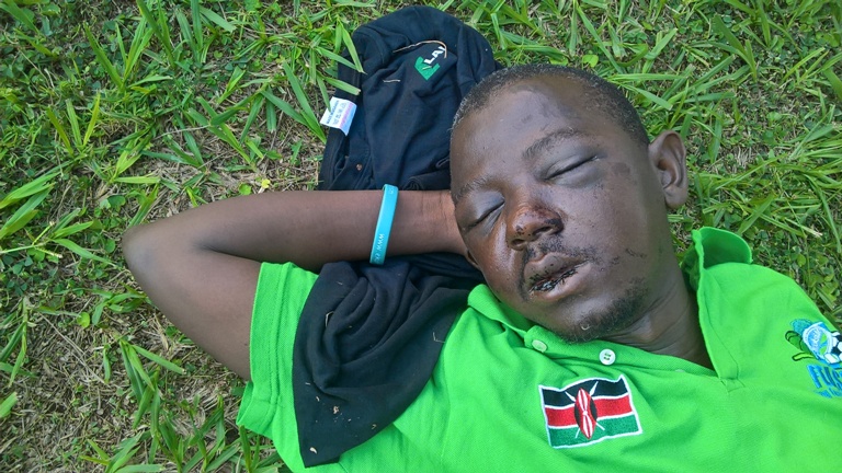 UPDF’s Noel Mwesigye Wanted Over Assault. Peter Kirunda with swollen face after he was assaulted by SFC's Maj. Noel Mwesigye.