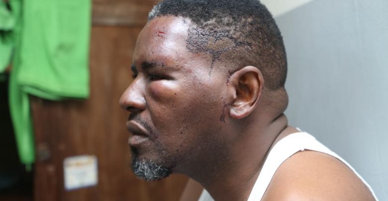 Kampala Capital City Authority (KCCA) spokesman Mr Robert Kalumba has accused supporters of the opposition National Unity Platform (NUP) of trying to end his life.