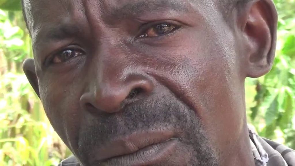 Bashir Mukaire whose man hood was cut by his 1st wife