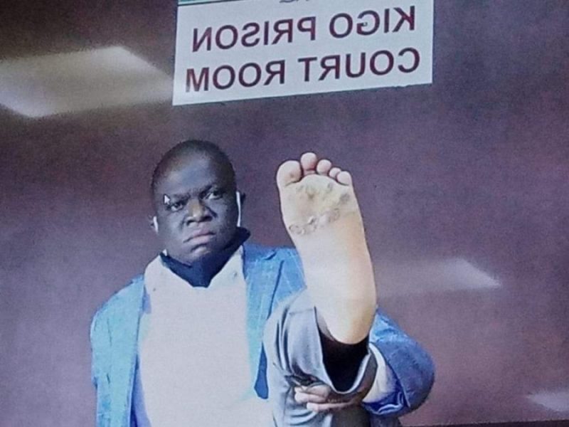 Kawempe MP Ssegirinya’s Feet Rotting In Prison MP Ssegirinya’s Feet Rotting In Prison – Uganda Mirror