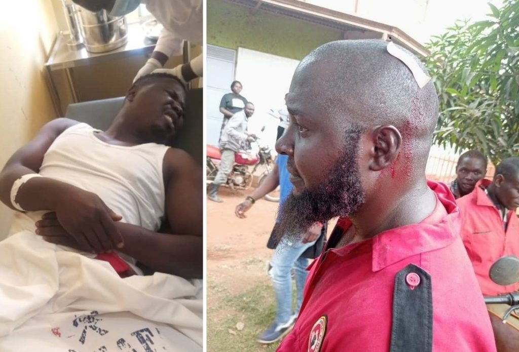 MP Zaake, NUP Leaders Injured in Kayunga Election Violence