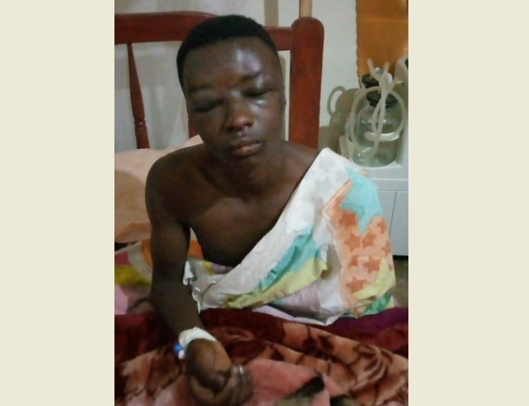Kabale Student Severely Beaten for Shouting in Library Kabale Student Severely Beaten for Shouting in Library