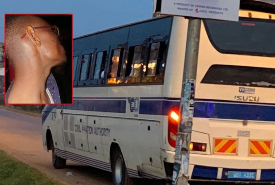 UBC journalist Sulah Kagugube (inset) displays injuries sustained after he was captured by UCAA officials aboard the bus shown in this photo on January 26, 2023. PHOTO/PAUL ADUDE