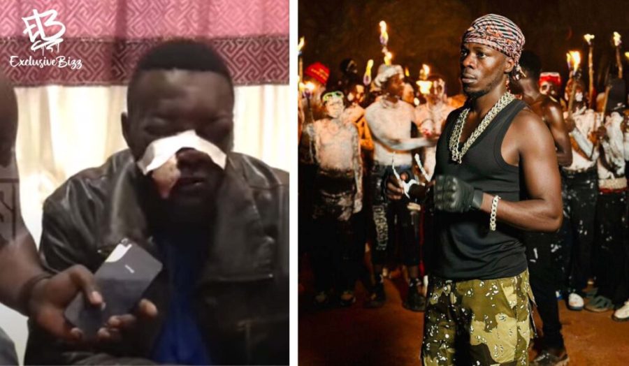 Alien Skin’s Critic Jajja Bamu Nursing Injuries After Being Assaulted the Singer’s Men